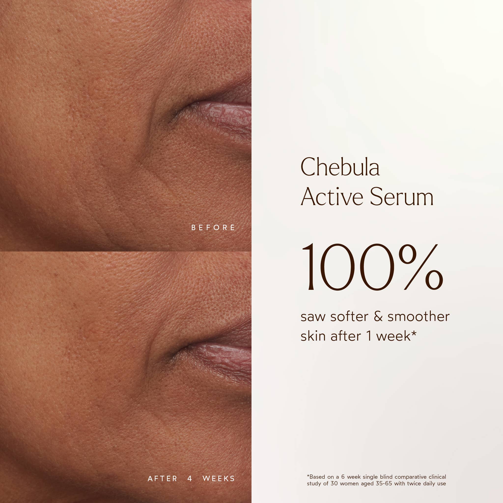 Anti-Aging Chebula Active Serum: Full Size (1 fl oz | 30 ml)
