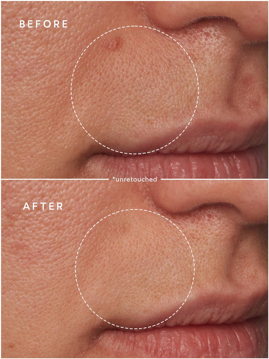 Renew Microbiome Enzyme Essence